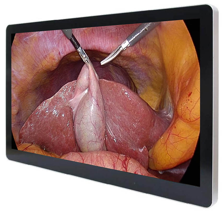 Medical Monitor 23.8″ FHD ECONT-0501.1